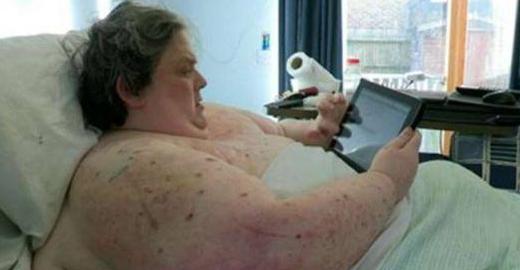 445公斤男子不愿减肥，X光照令人汗颜，医生称其活不过两年