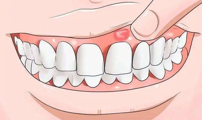 爱齿尔口腔 | 总是牙龈肿痛怎么办？
